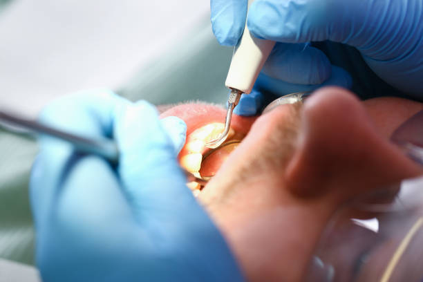 Best Emergency Dental Services for Seniors in Monticello, IA