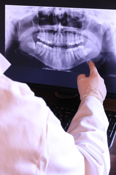 Best Emergency Dentist for Knocked-Out Tooth in Monticello, IA