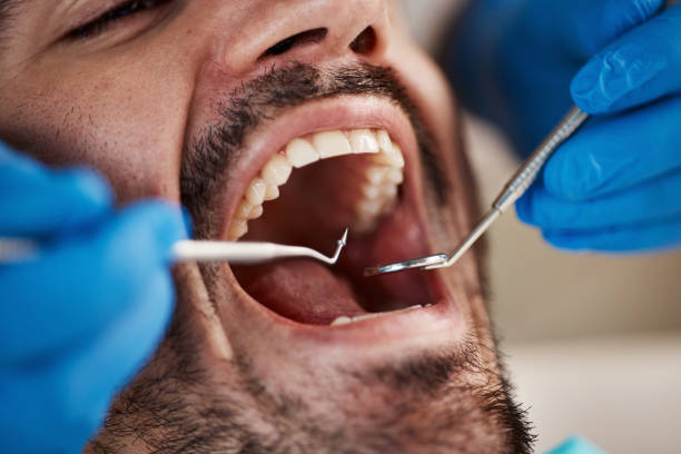 Best Emergency Dental Extractions in Monticello, IA