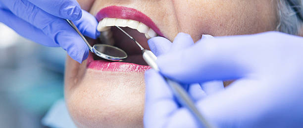 Best Urgent Dental Care for Toothache in Monticello, IA